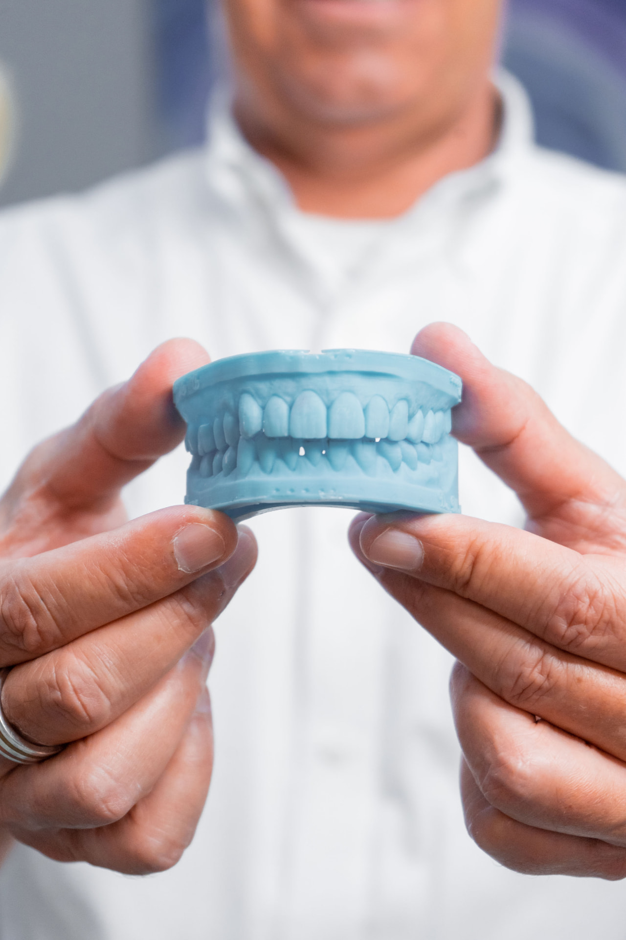 Modelo odontológico produzido com impressão 3D